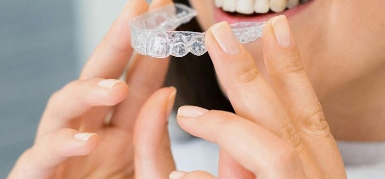 Fă-i cadou de sărbători un tratament cu aparat dentar Invisalign: ingenios și util!